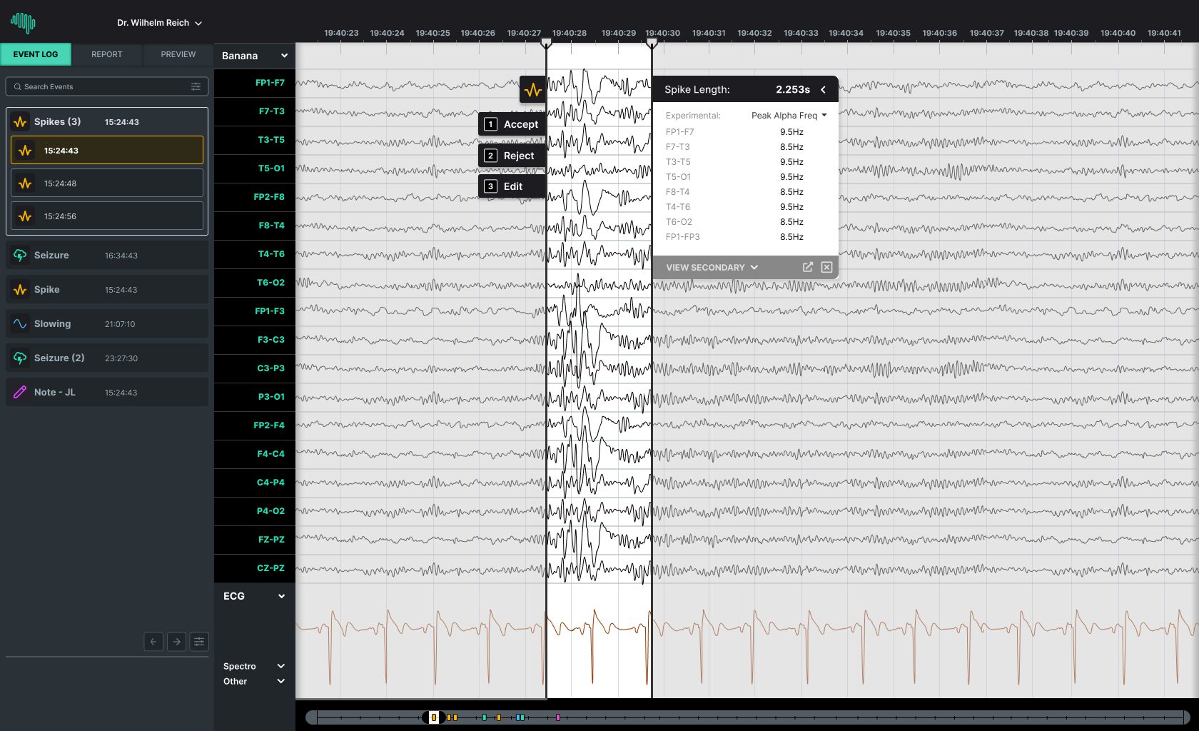 Beacon-Viewer-2-Adjudicate