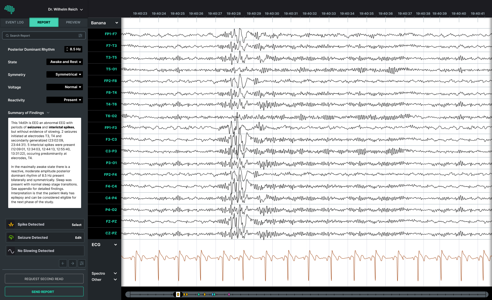 Beacon-Viewer-3-Report-Completion
